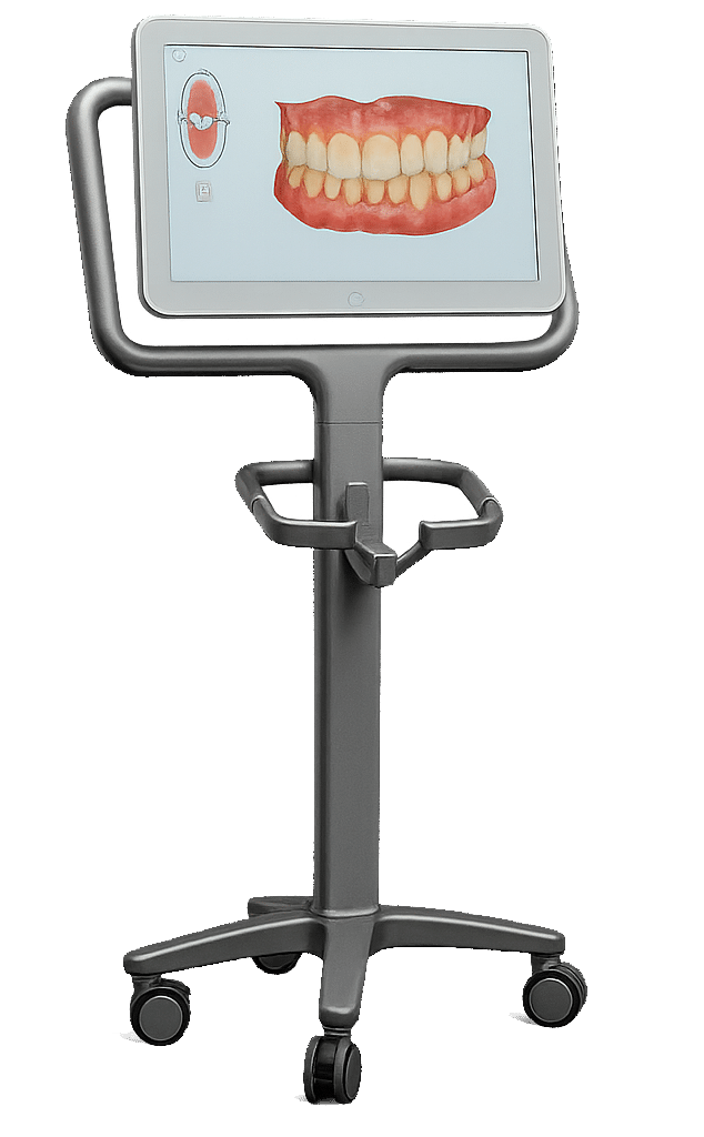 iTero scanner showing digital impressions on screen